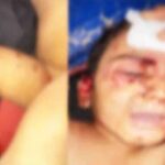 azadnagarmadhye bhatkya kutryancha don varshachya chimuklyavar pranghatak halla