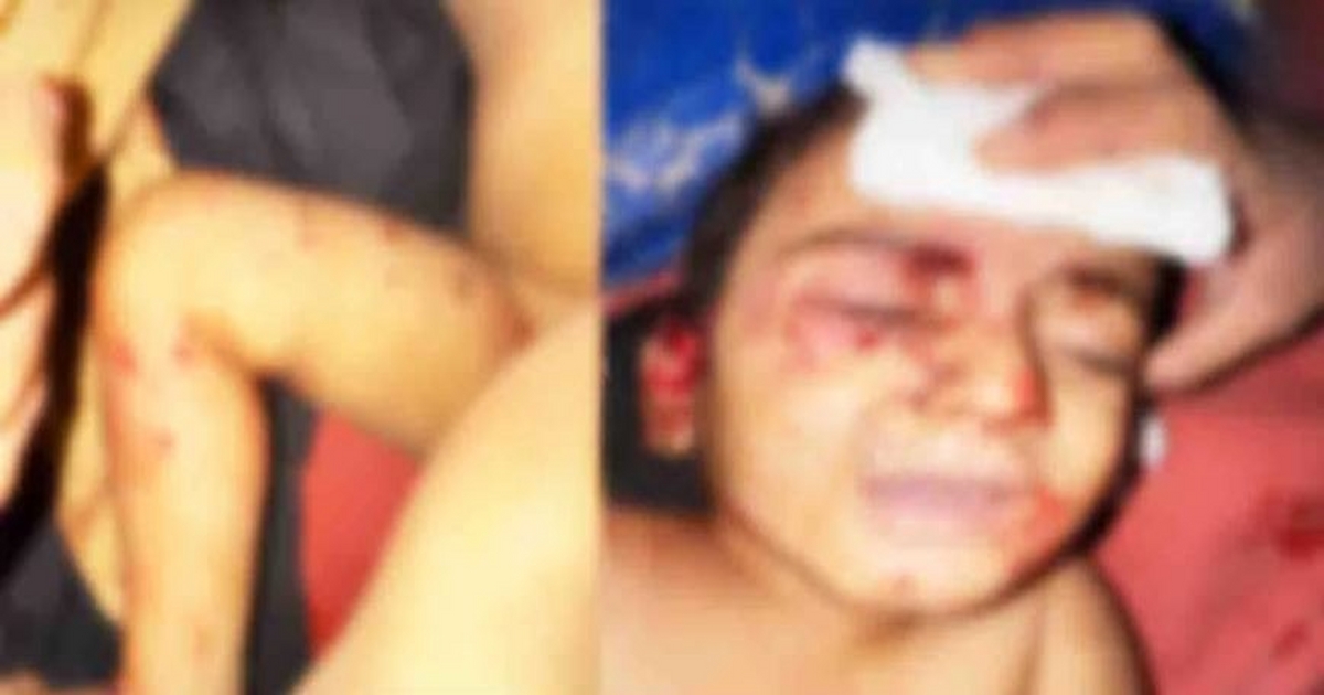 azadnagarmadhye bhatkya kutryancha don varshachya chimuklyavar pranghatak halla