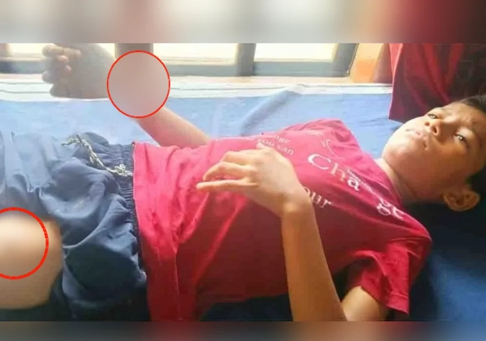 nipanit bhatkya kutryanchya hallyat 11 varshiya mulga gambhir jakhmi